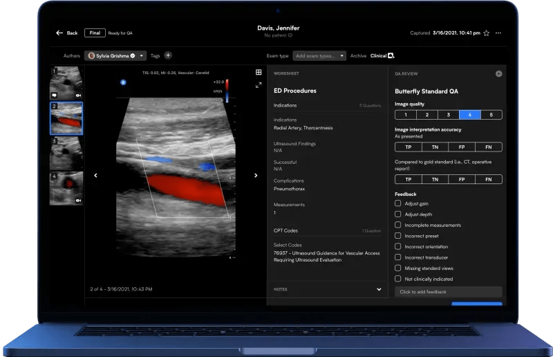 Butterfly Network iQ (Best for rapid image assessment in primary care)