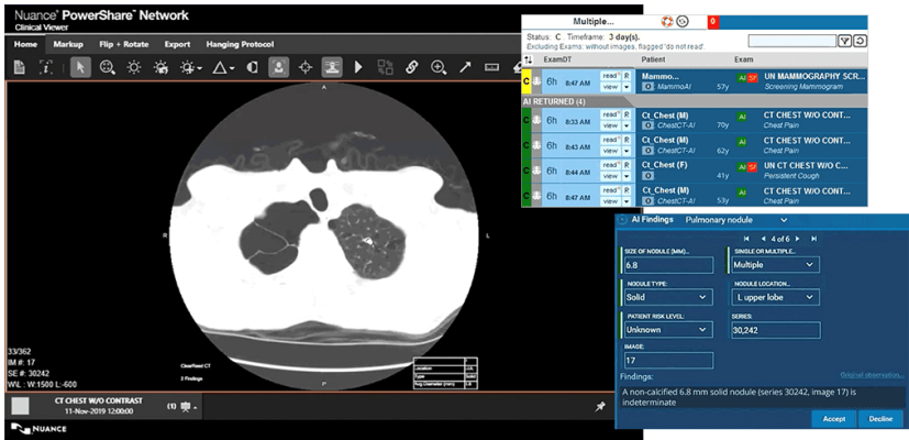 Zebra Medical Vision Dashboard